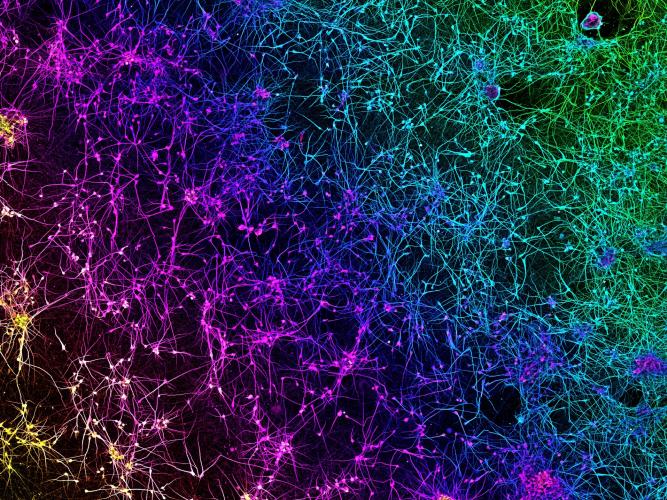 dopamine network