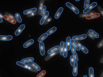 e coli bacterial cells 7