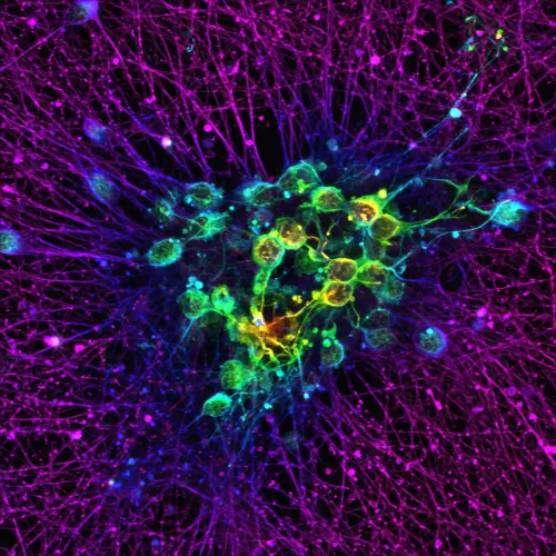Fluorescence microscopy image of a dense neural network, with branching fibres glowing magenta and purple around clustered cells highlighted in green, yellow and cyan against a black background.