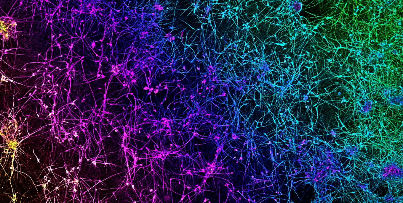 Microscopy image of a dense neural network, with intricate branching fibres glowing in vibrant magenta, purple, blue, cyan, green and yellow against a black background.